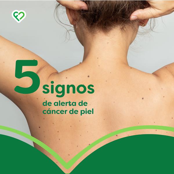 5 signos de alerta de cáncer de piel